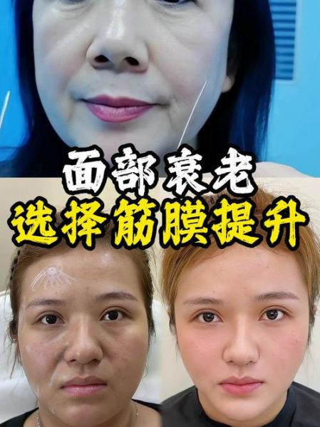面部松弛下垂怎么改善_面部轮廓不清晰怎么办