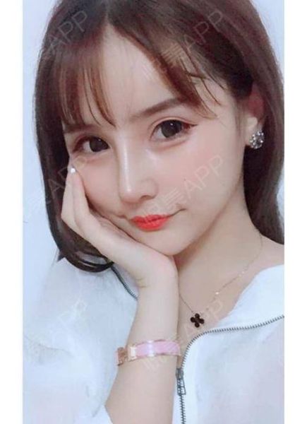 隆鼻会不会影响运势_隆鼻后运势会变好吗