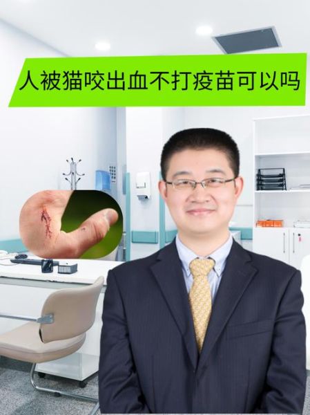 梦到被猫咬是什么意思_梦见猫咬手有什么预兆