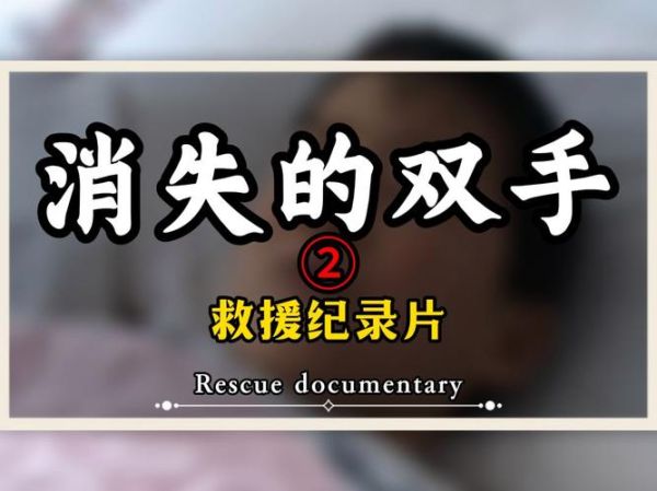 梦到手被砍断_预示什么