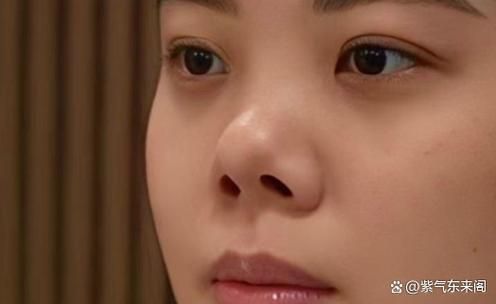 鼻梁低会影响财运吗_鼻梁塌怎么改运