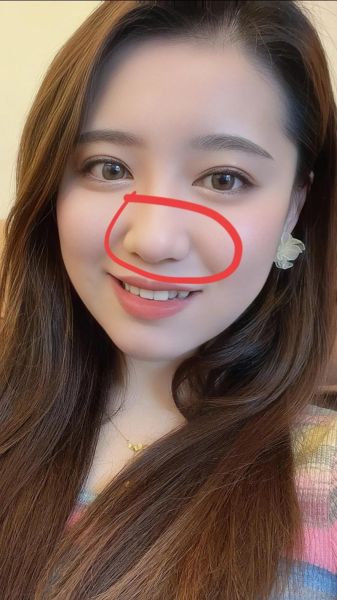 肉鼻子财运视频_肉鼻子面相真的招财吗