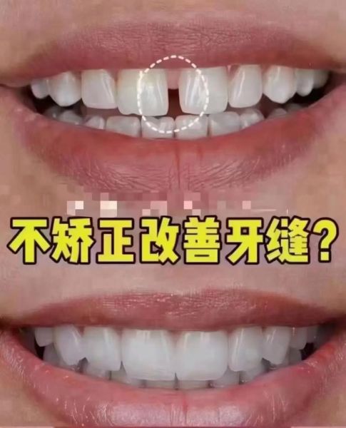 门牙缝大影响财运吗_门牙缝看财运准不准