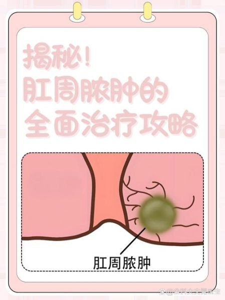 梦到脓肿是什么意思_梦到脓肿预示什么