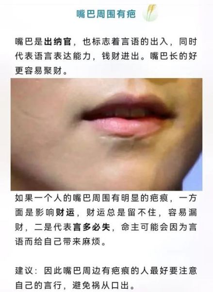 脸上有疤痕影响运势吗_如何化解面相疤痕带来的霉运