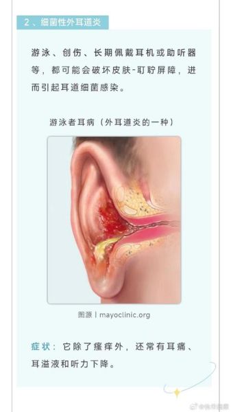 耳朵痒财运_耳朵痒代表什么预兆