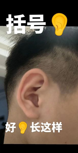 耳垂天生缺一块运势_会影响财运吗