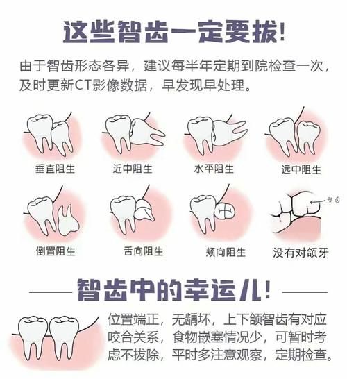 长智齿预示着什么运势_智齿与命运的关系