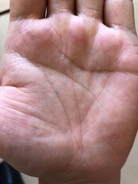 财运线棺材纹是什么_财运线棺材纹怎么破解