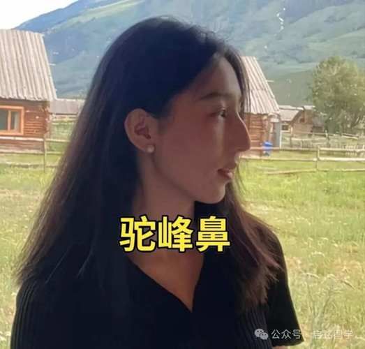 驼峰鼻影响财运吗_驼峰鼻面相财运解析