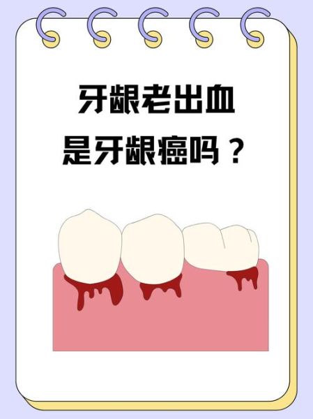 梦到牙龈出血_意味着什么