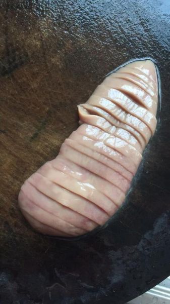 梦到被剖腹是什么意思_梦到被剖腹预示什么