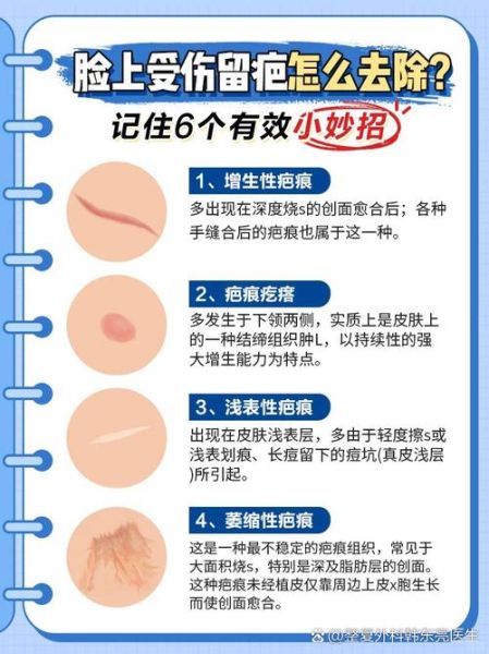 面部疤痕影响财运吗_面部疤痕如何改运