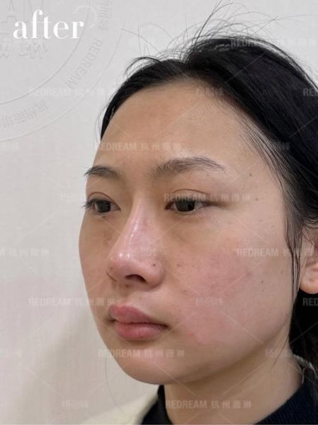 脸上动刀会影响运势吗_整容后运气真的变差了吗