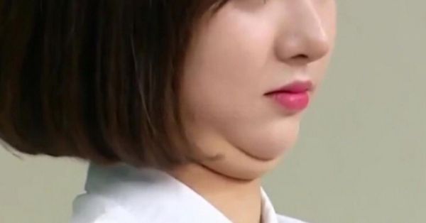 女生有双下巴财运_双下巴面相财运好吗