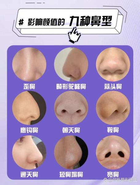 鼻子歪会影响运势吗_鼻子歪怎么改运