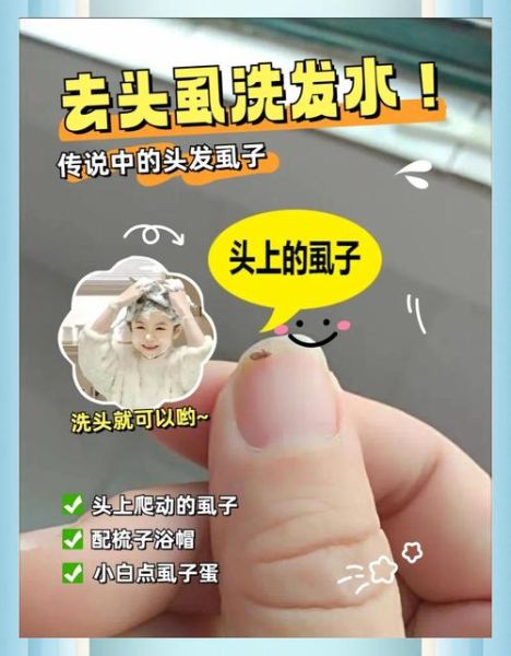 梦到虱子卵是什么意思_如何化解