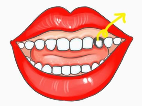 梦见自己长牙_周公解梦