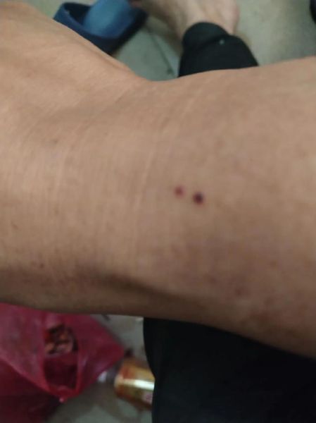 梦到被蜈蚣咬到手是什么意思_怎么破解