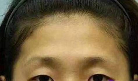 露出额头运势好吗_额头露出来真的招财吗