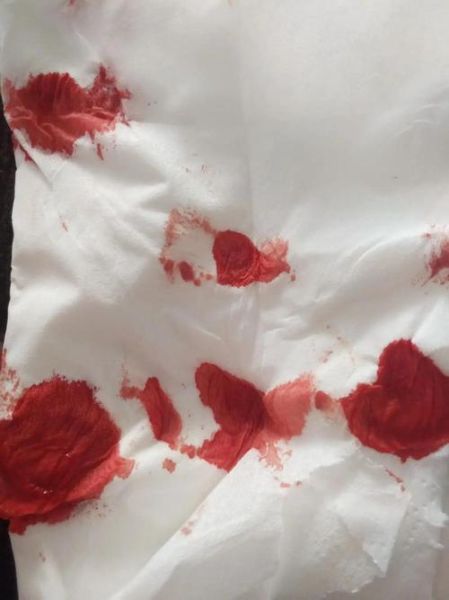 梦到血止不住的往外喷_什么预兆