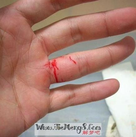 梦到把别人打出血_意味着什么