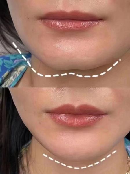 下巴尖的人财运怎么样_下巴尖的人财运好吗