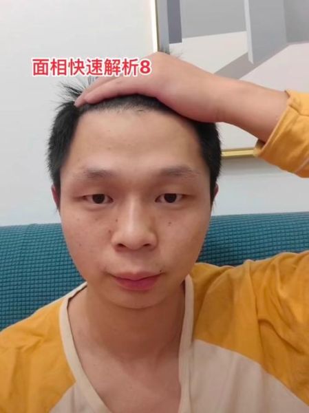 眉毛稀少影响财运吗_如何补救