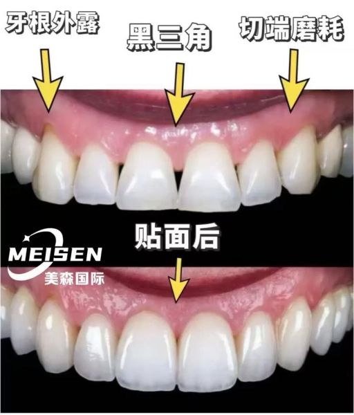 牙齿真的影响财运吗_牙齿风水与财富关系