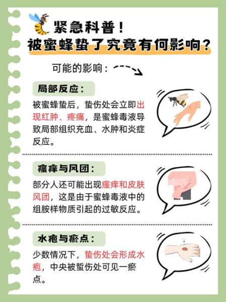 梦到被马蜂蛰是什么意思_被马蜂蛰梦境解析