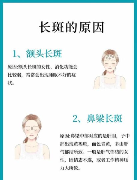 梦到长雀斑_是什么意思 梦到长雀斑_是什么意思