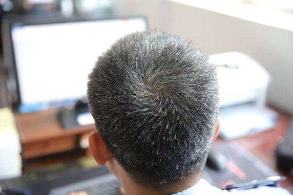 梦到满头白发是什么意思_白发梦境解析 梦到满头白发是什么意思_白发梦境解析