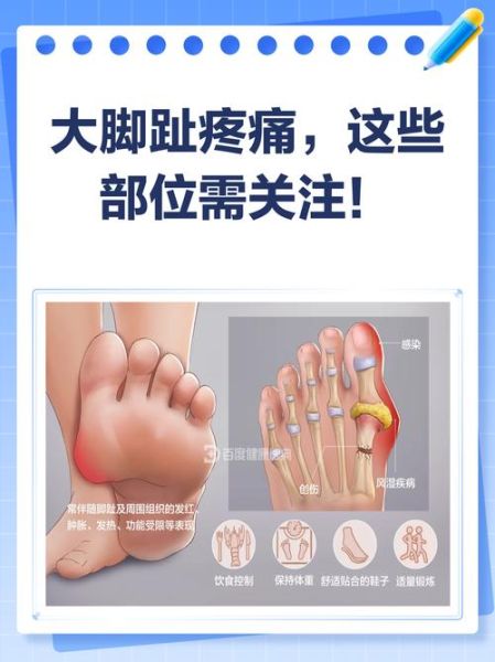 梦到脚趾疼_意味着什么