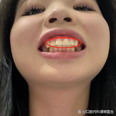 龅牙人的财运怎么样_龅牙影响财运吗