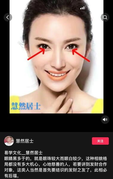 开眼角影响运势吗_开眼角会改变面相风水吗