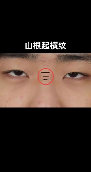 山根主管财运吗_山根低陷真的破财吗