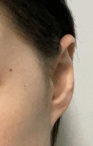 反耳骨财运_反耳骨会影响财运吗