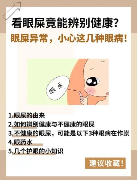 梦到眼屎是什么意思_梦见眼屎很多怎么办
