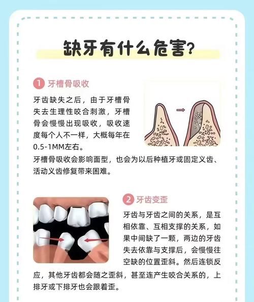 缺牙会影响财运吗_缺牙风水怎么破解