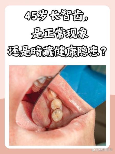 长智齿运势_智齿影响运气吗