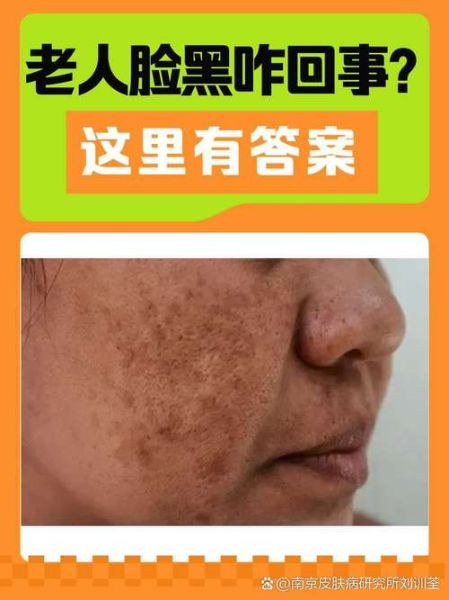 脸色发黑运势_脸色发黑预示什么