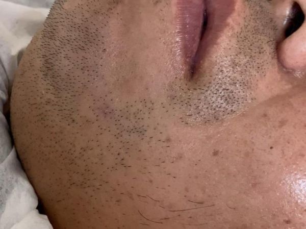 梦到刮脸是什么意思_梦见自己刮胡子预示什么