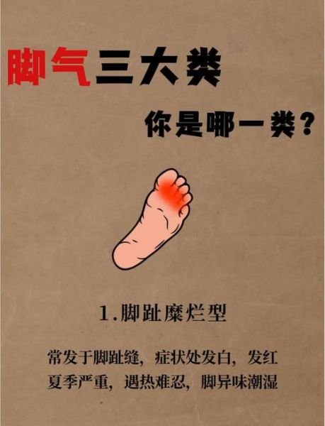脚气会影响财运吗_脚气与财运的关系