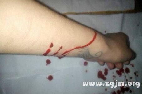 梦到被砍是什么意思_梦见被砍伤预示什么