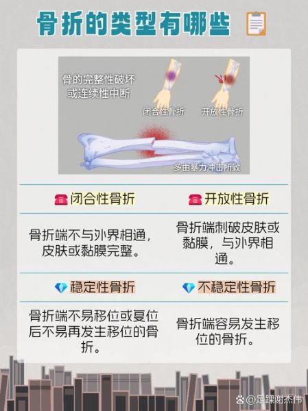 梦到骨折是什么意思_梦到骨折预示什么