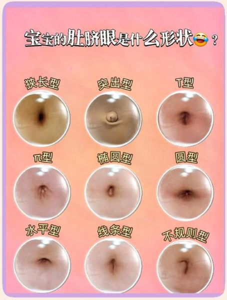 肚脐眼是平的财运如何_肚脐平的人财运真的差吗