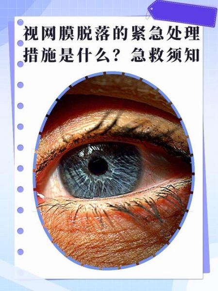 梦到眼球破了_梦见眼球破裂预示什么