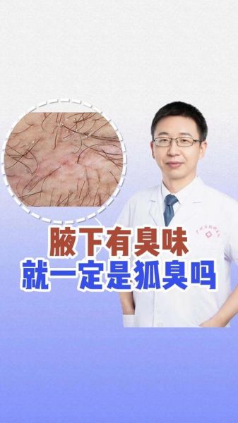 狐臭多的属相有哪些_狐臭与生肖体质关系