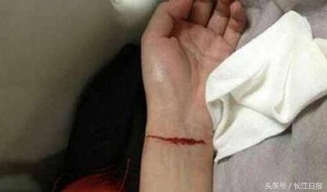梦到手腕被割破_梦见手腕流血是什么意思