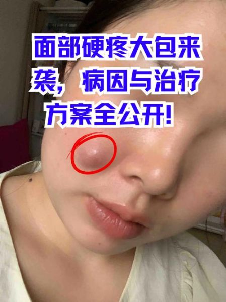 梦到脸流脓_预示什么